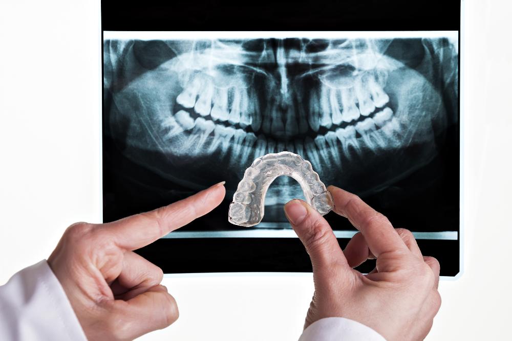 invisalign clear aligner next to x-ray | invisalign farmington hills mi