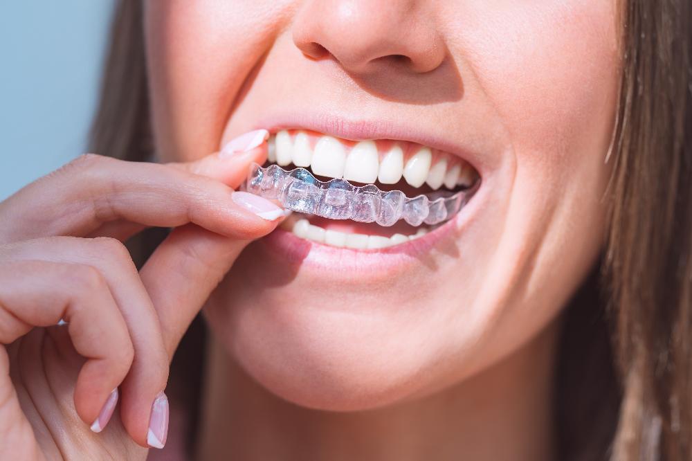 patient putting in clear plastic aligner | invisalign farmington hills mi