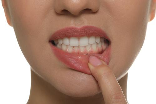 patient looking at gums | periodontal disease treatment farmington hills mi
