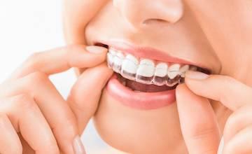 patient putting in invisalign clear aligner | dentist farmington hills mi