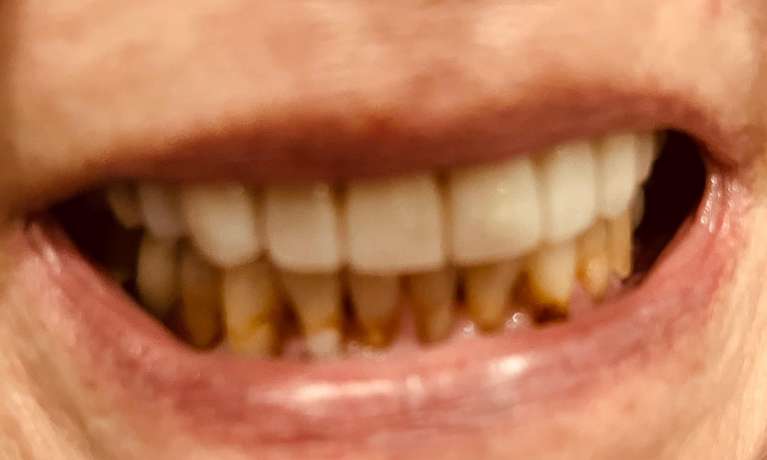 Cosmetic-Dentistry-Before-Image
