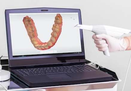 computer with mouth impression model | barone family dental